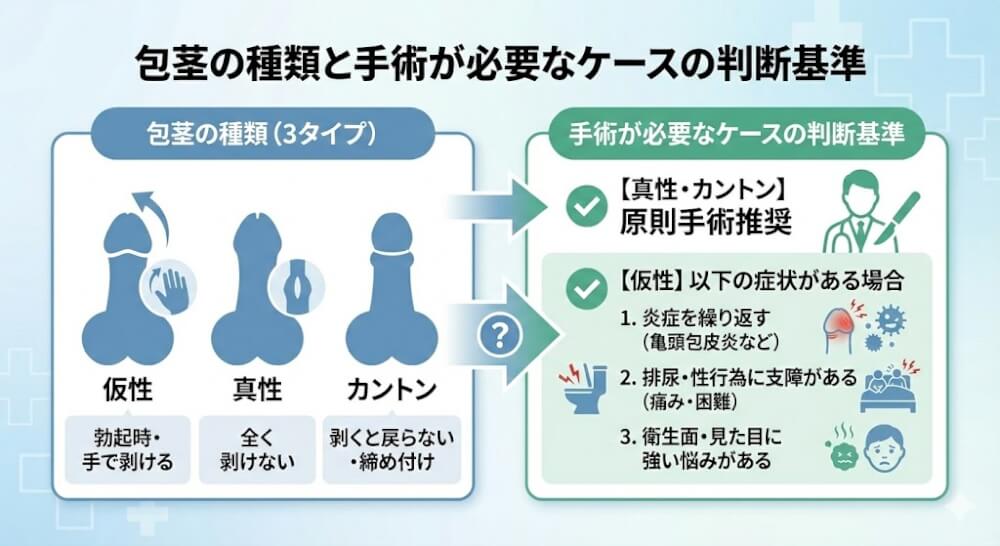 包茎の種類と手術が必要なケースの判断基準