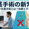 包茎手術の新常識｜切らない包茎手術とは？効果とデメリット