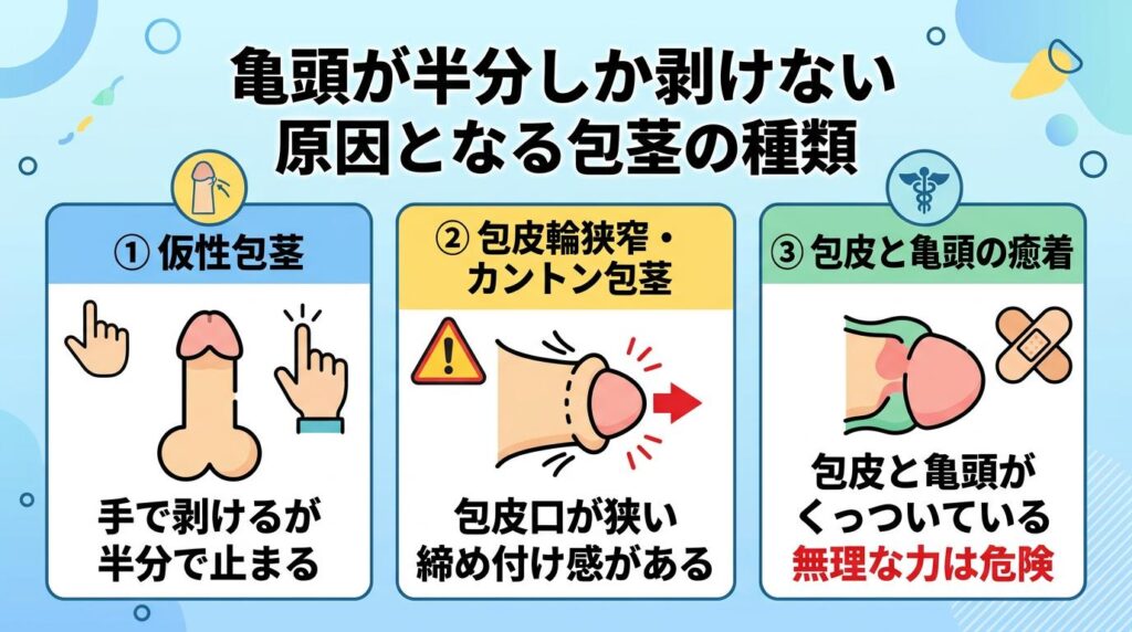 亀頭が半分しか剥けない原因となる包茎の種類