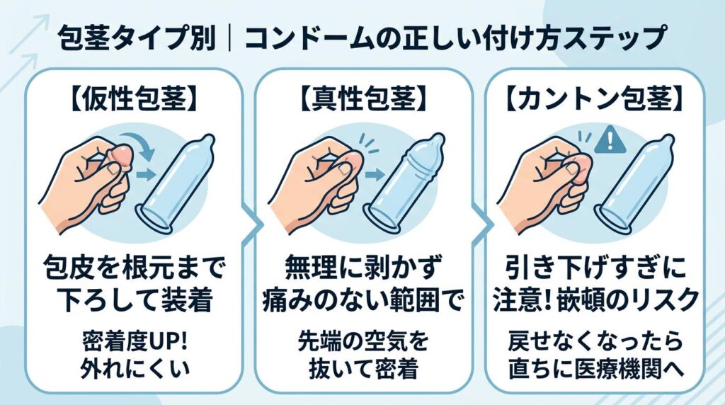 包茎タイプ別｜コンドームの正しい付け方ステップ