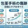 包茎手術の傷跡が心配な方へ｜原因・経過・正しいケアを解説