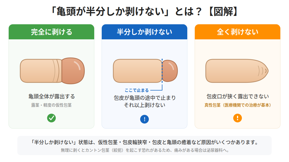 亀頭が半分しか剥けない状態の図解（完全に剥ける・半分しか剥けない・全く剥けない状態の比較）