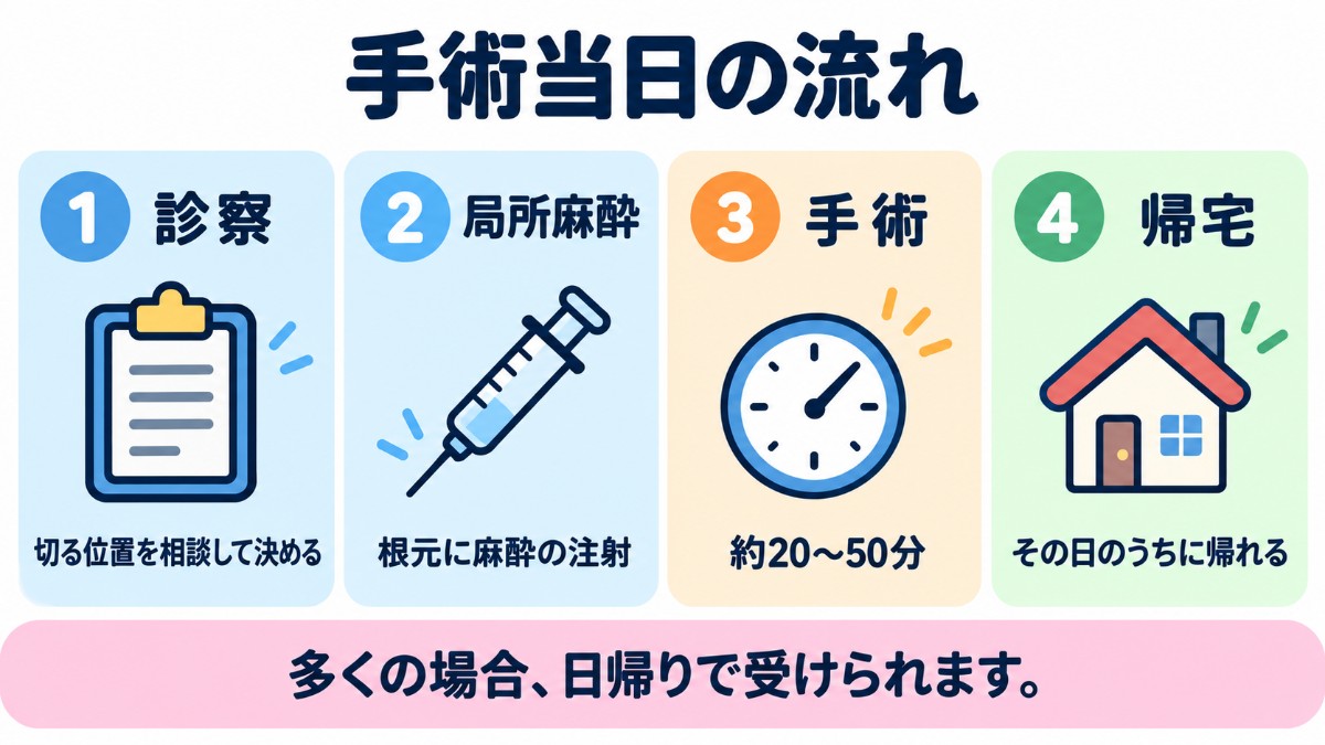 環状切除術の手術当日の流れ（診察、局所麻酔、手術、帰宅）