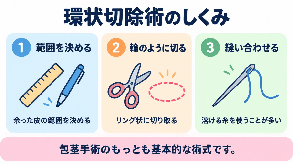 環状切除術のしくみ（余った皮の範囲を決める、リング状に切り取る、縫い合わせる）