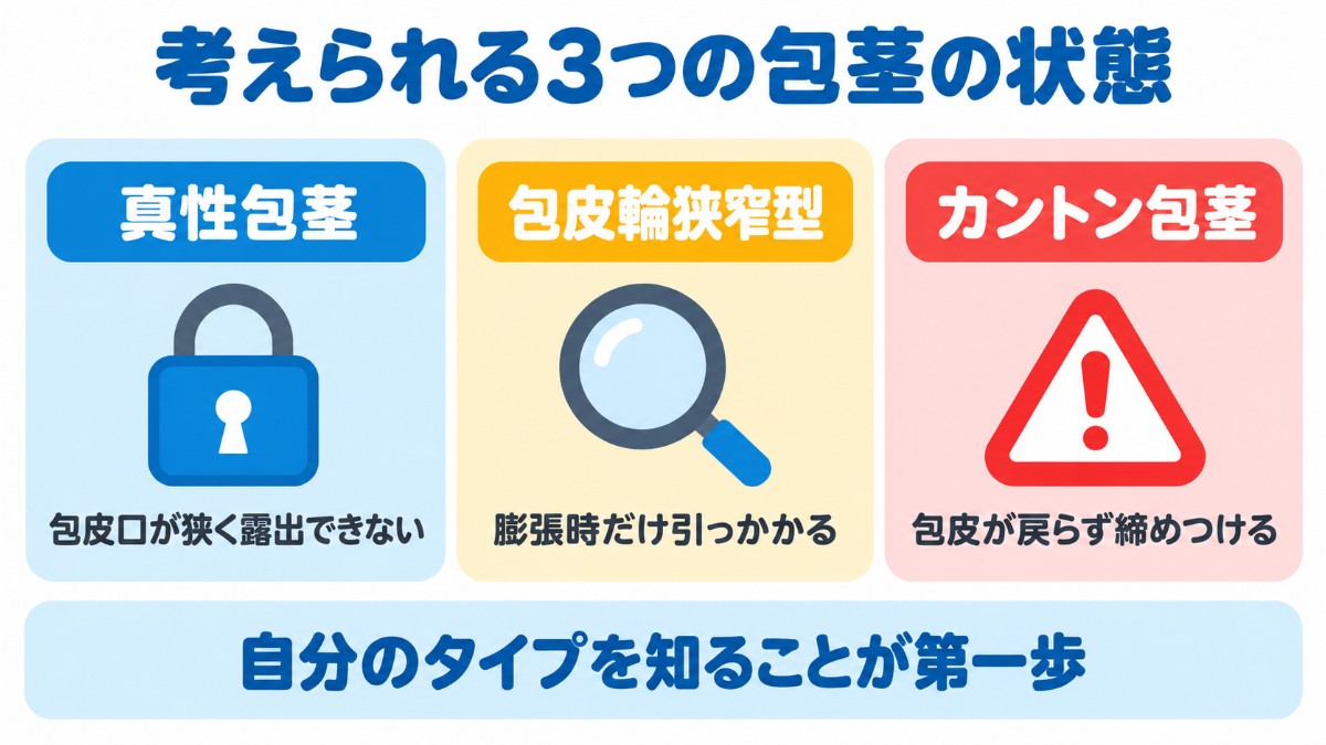 膨張時に包皮が下がらない原因として考えられる真性包茎・包皮輪狭窄型・カントン包茎の3つの状態を並べた図