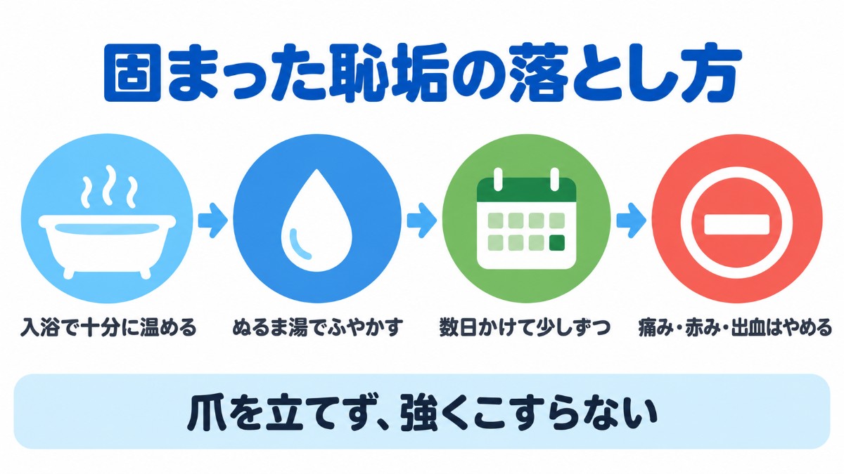 固まった恥垢を入浴で温め、ぬるま湯でふやかし、数日かけて少しずつ落とし、痛みや赤み・出血があればやめるという流れを矢印でつないだ図