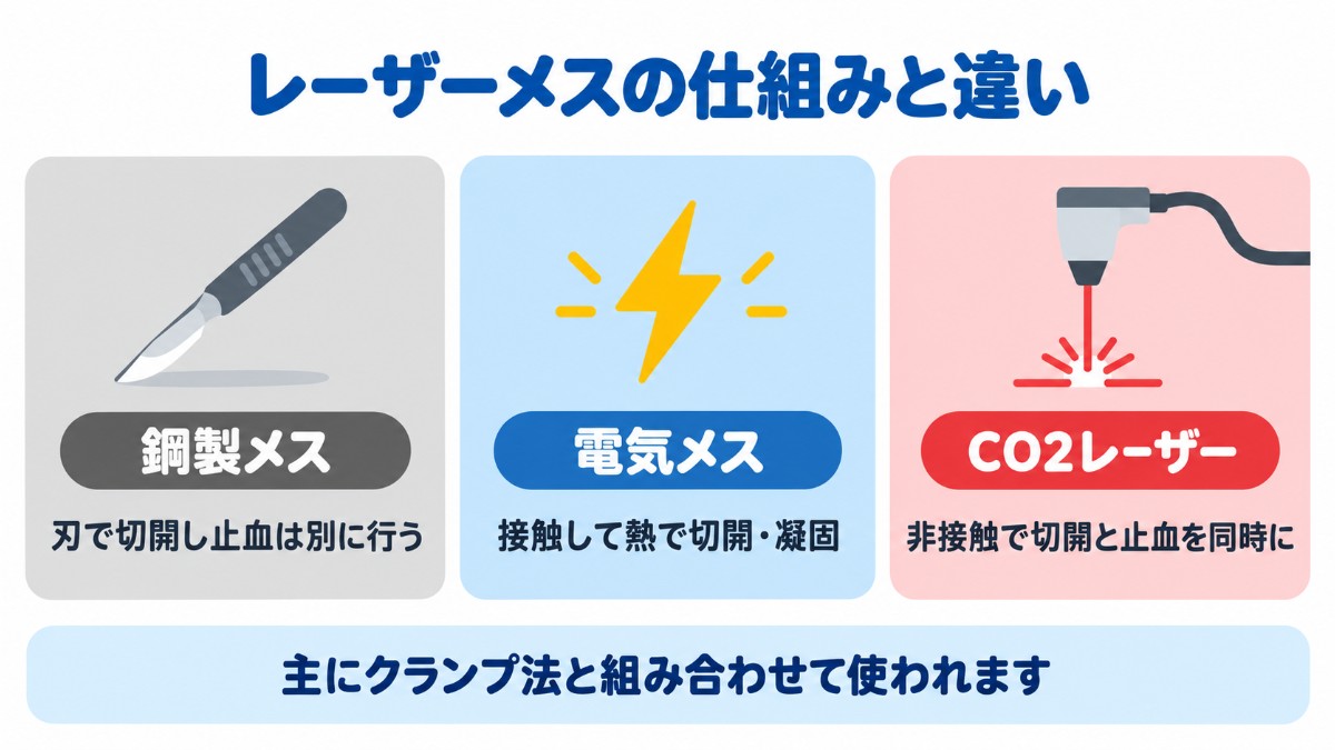 包茎手術で使われる3種類のメスの違いを、刃で切開して止血は別に行う鋼製メス、接触して熱で切開・凝固する電気メス、非接触で切開と止血を同時に行うCO2レーザーで比べた図