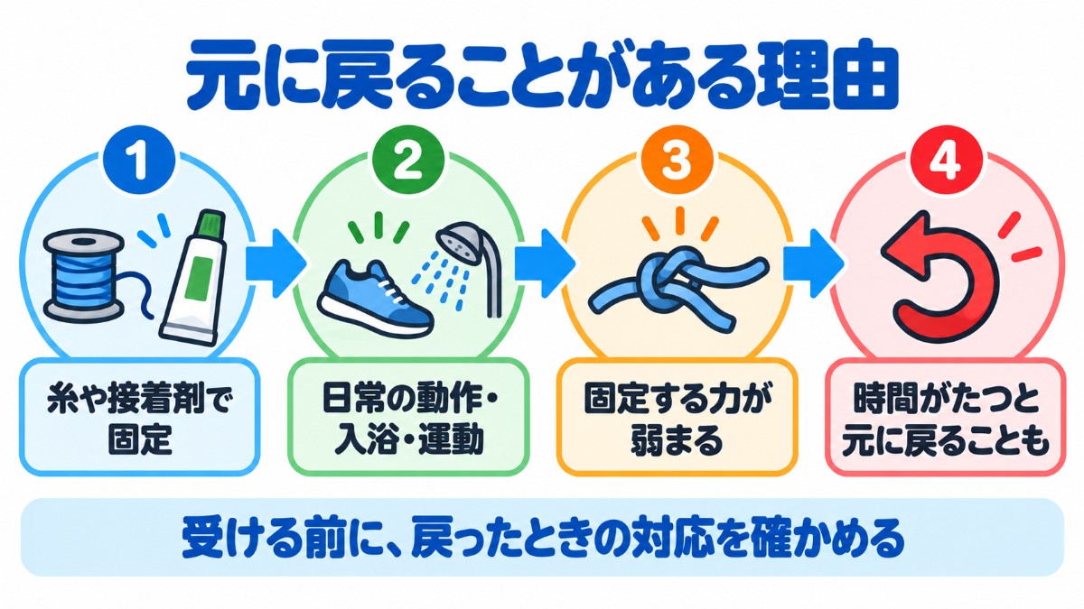 糸や接着剤による固定が弱まり、時間がたつと元に戻ることがある流れを示した図