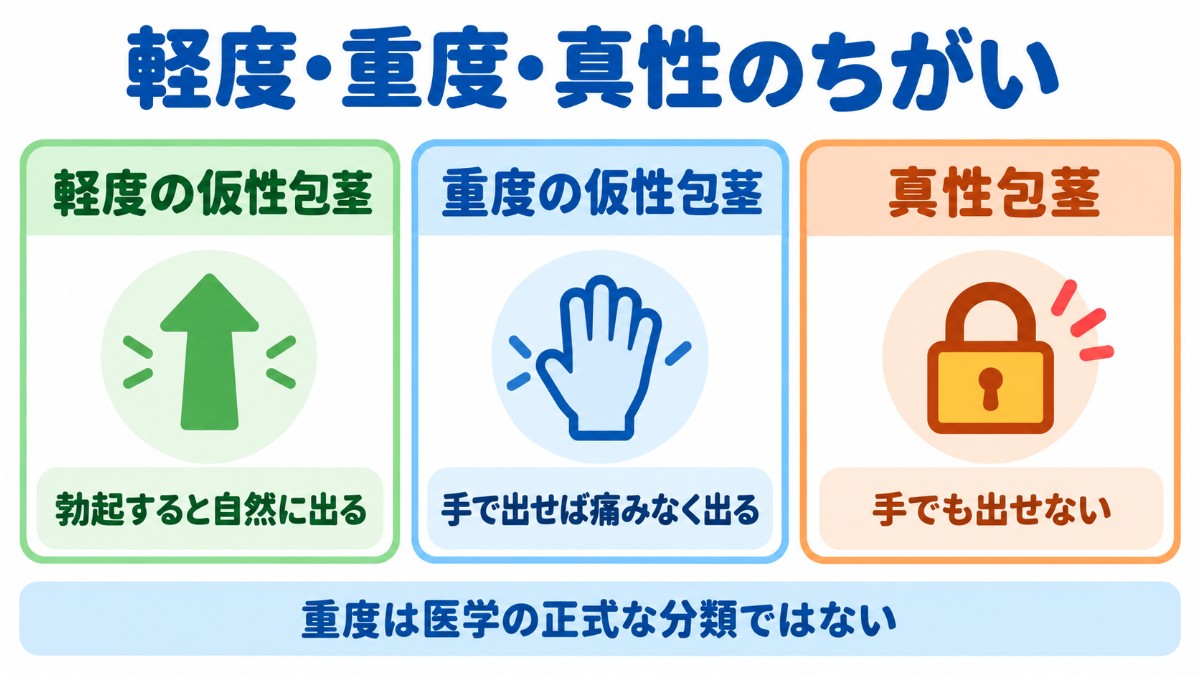 軽度・重度の仮性包茎と真性包茎の違いを比べた図