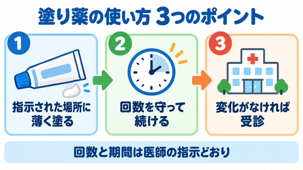 ステロイド軟膏の使い方の3つのポイントを示した図